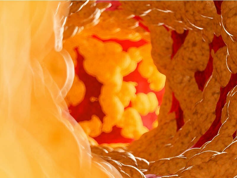 Are your cholesterol levels too high? How to check and what to do approximately it