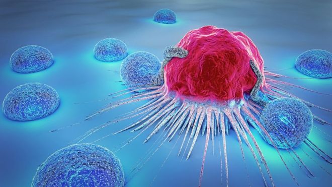 Embarrassment placing Australian ladies prone to cervical cancer, research reveals