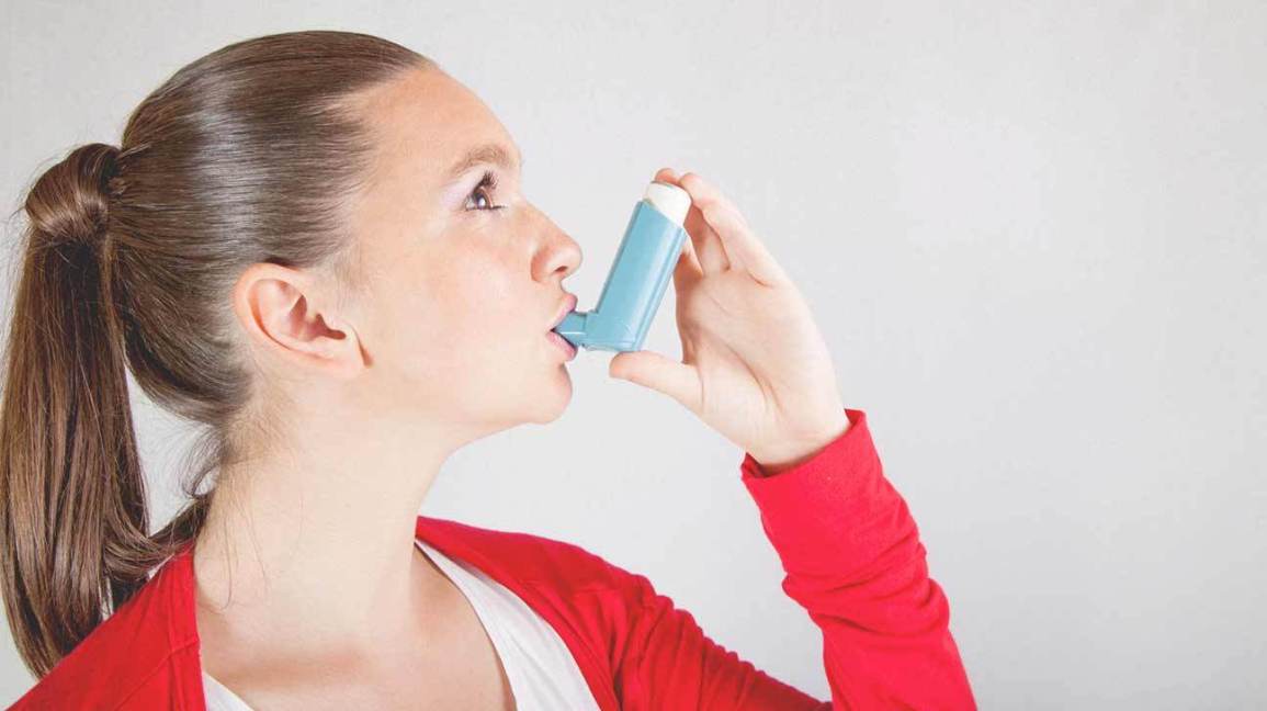  Mild Asthma