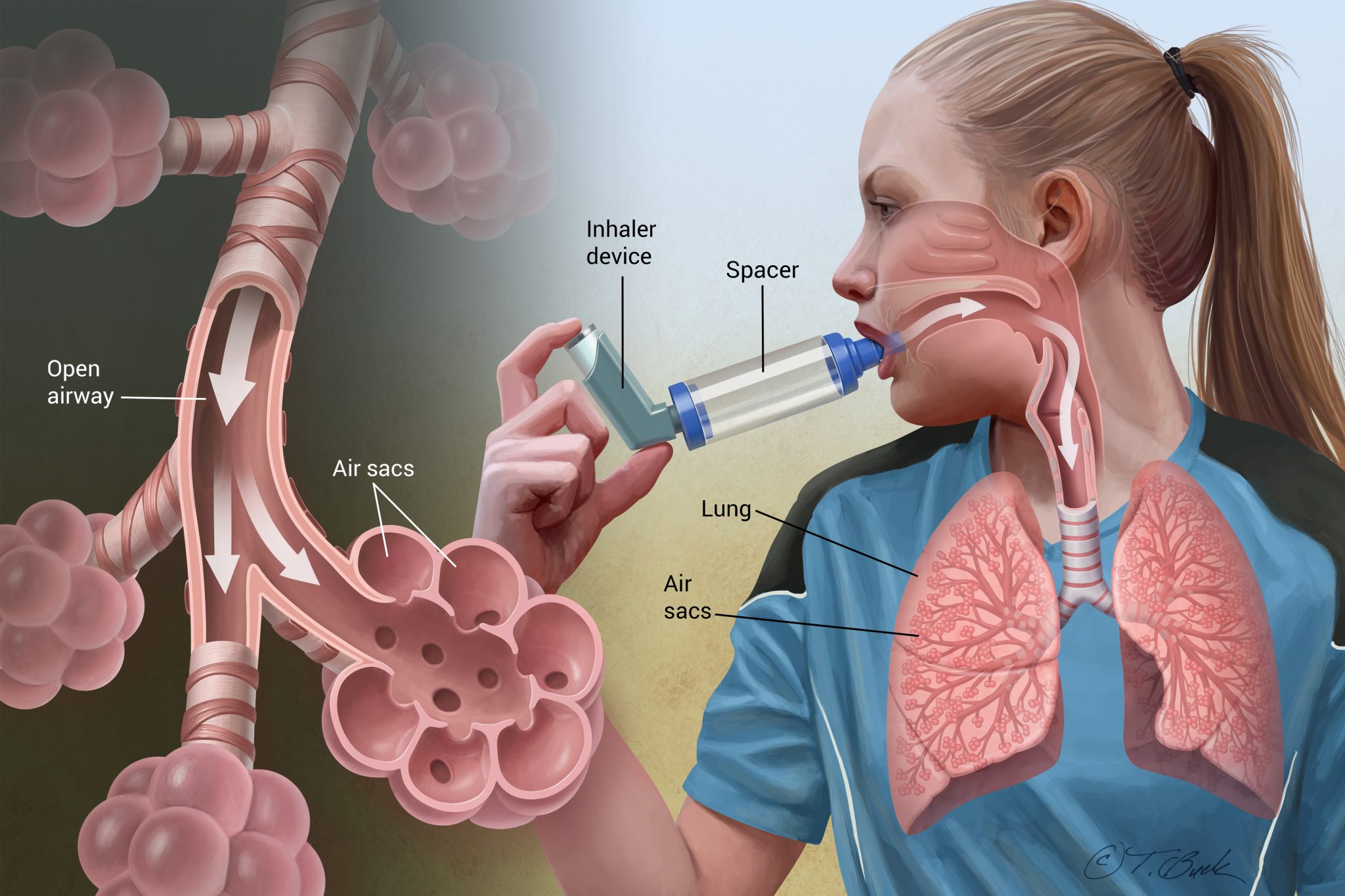 Cellular Differences in Asthma Identified in First Lung Mapping Project
