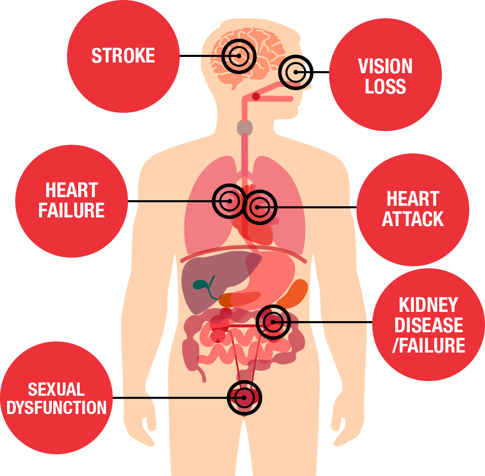 High blood stress – Eating this 79p vegetable will decrease the hazard of high blood pressure