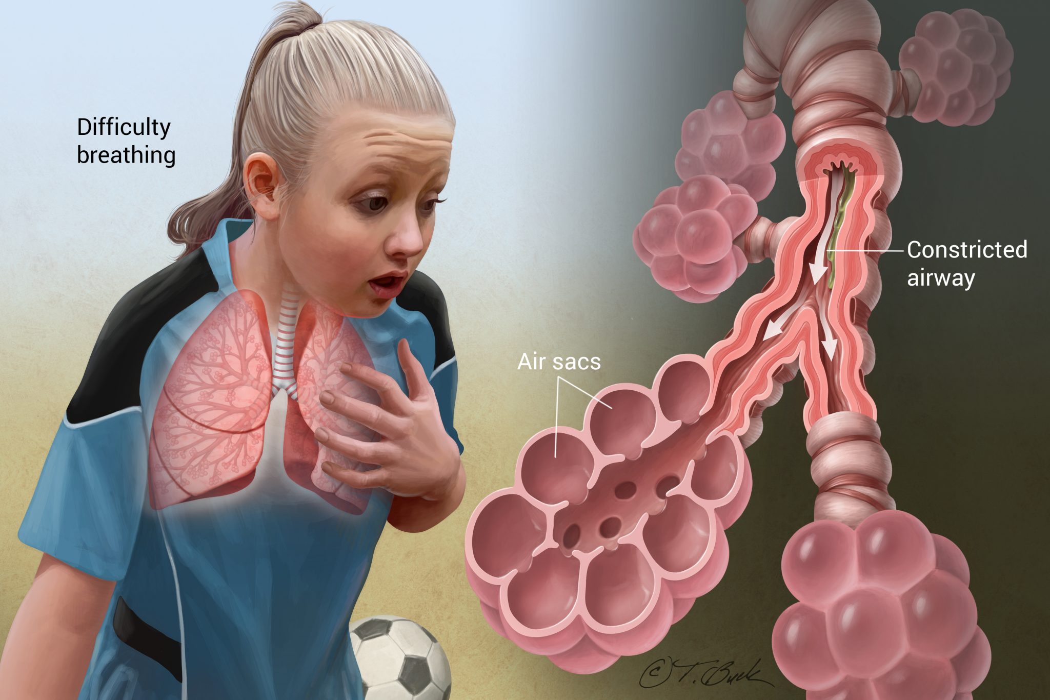 Global Asthma and COPD Drugs Market Analysis 2019-2025: GlaxoSmithKline, Novartis, Merck, Abbott Laboratories
