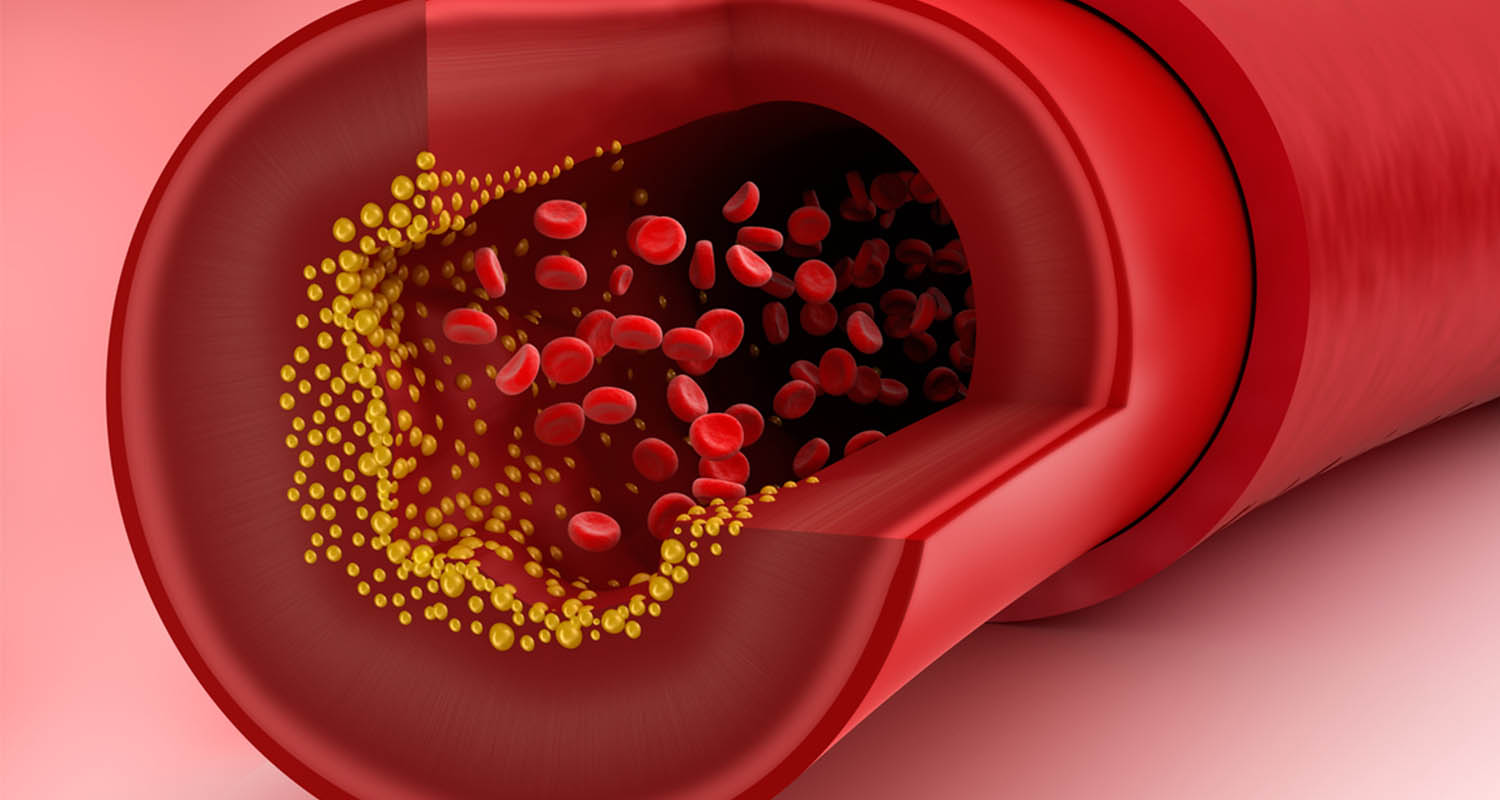 cholesterol