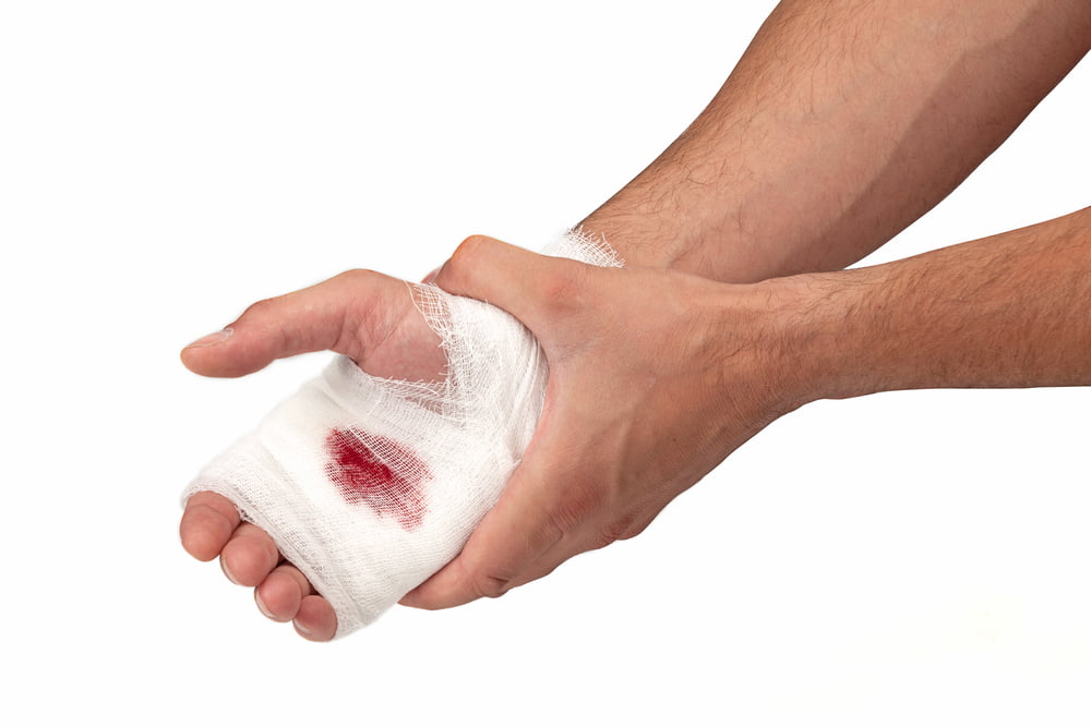 Family marketers flip children’ head accidents into enterprise opportunity