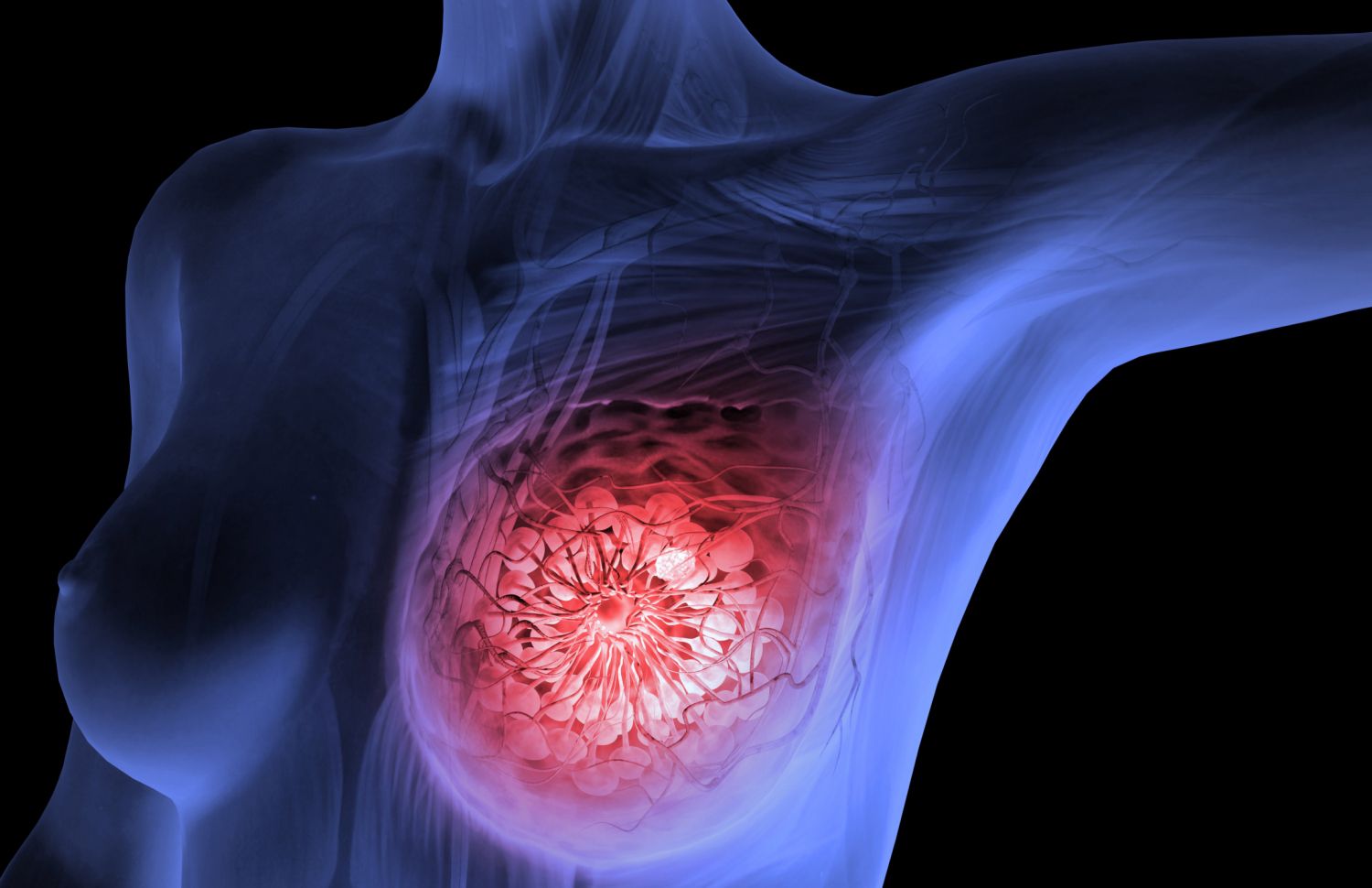 A girl discovered she had breast cancer after her son refused to feed from certainly one of her breasts, and it is probable because the tumor made her milk taste bitter