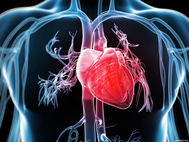 cardiac deaths 