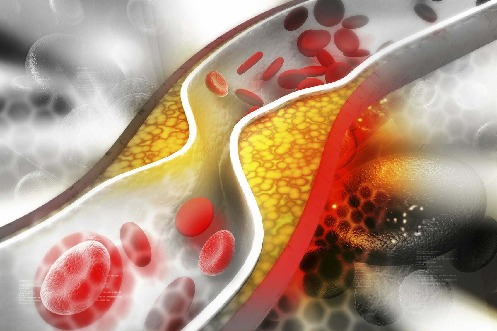 Best supplements for cholesterol: Fish oil can improve ‘right’ levels of cholesterol says take a look at