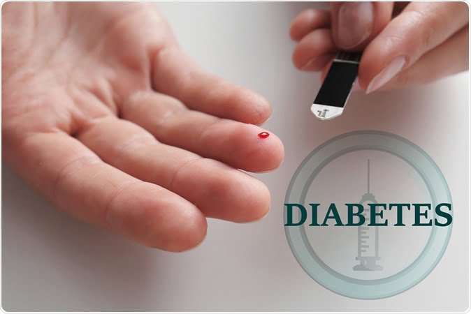 Intermittent fasting protects mice from type 2 diabetes