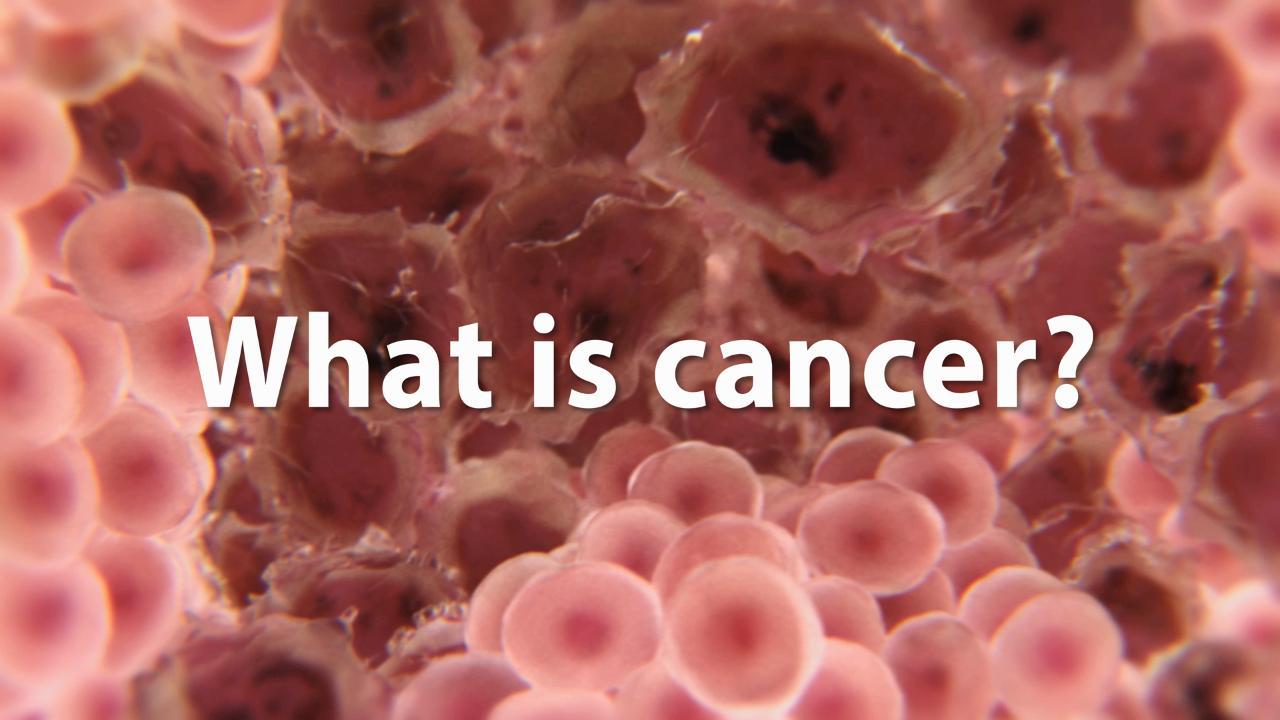 Are docs treating extra thyroid most cancers sufferers than necessary?