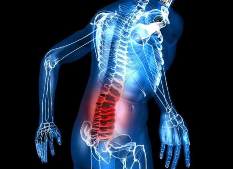 Are decrease back ache and constipation related?