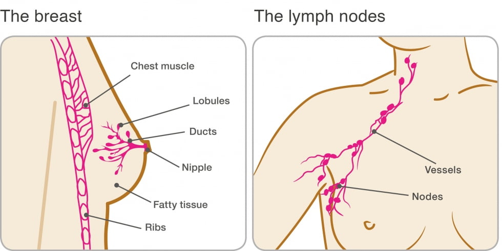 Why do a little patients decline DBT for breast cancer screening?