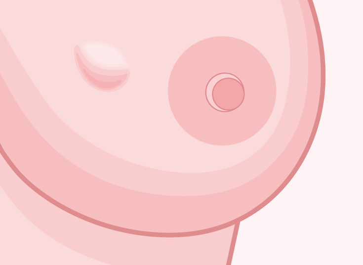 What Women Veterans Should Know About the Heightened Risk for Breast Cancer