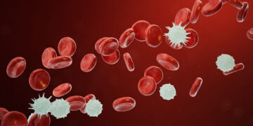 10 Proven Ways to Fight Blood Cancer and Keep it Away Forever