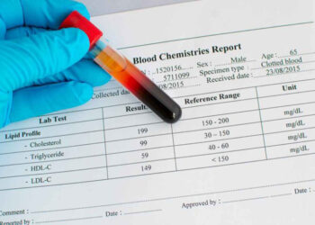 Hdl Cholesterol Low – How to Keep It
