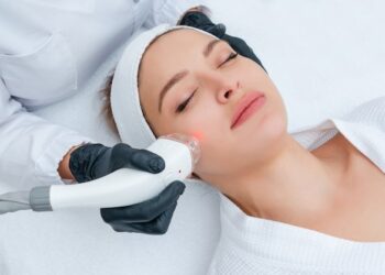 Laser Treatment for Acne: What You Need to Know Before You Go