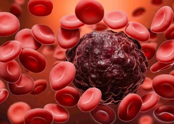 Blood Cancer: A Comprehensive Guide for People Living With This Disease