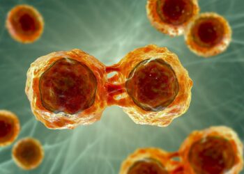 Multiple Myeloma – A Cancer That Doesn’t Have Any Cure